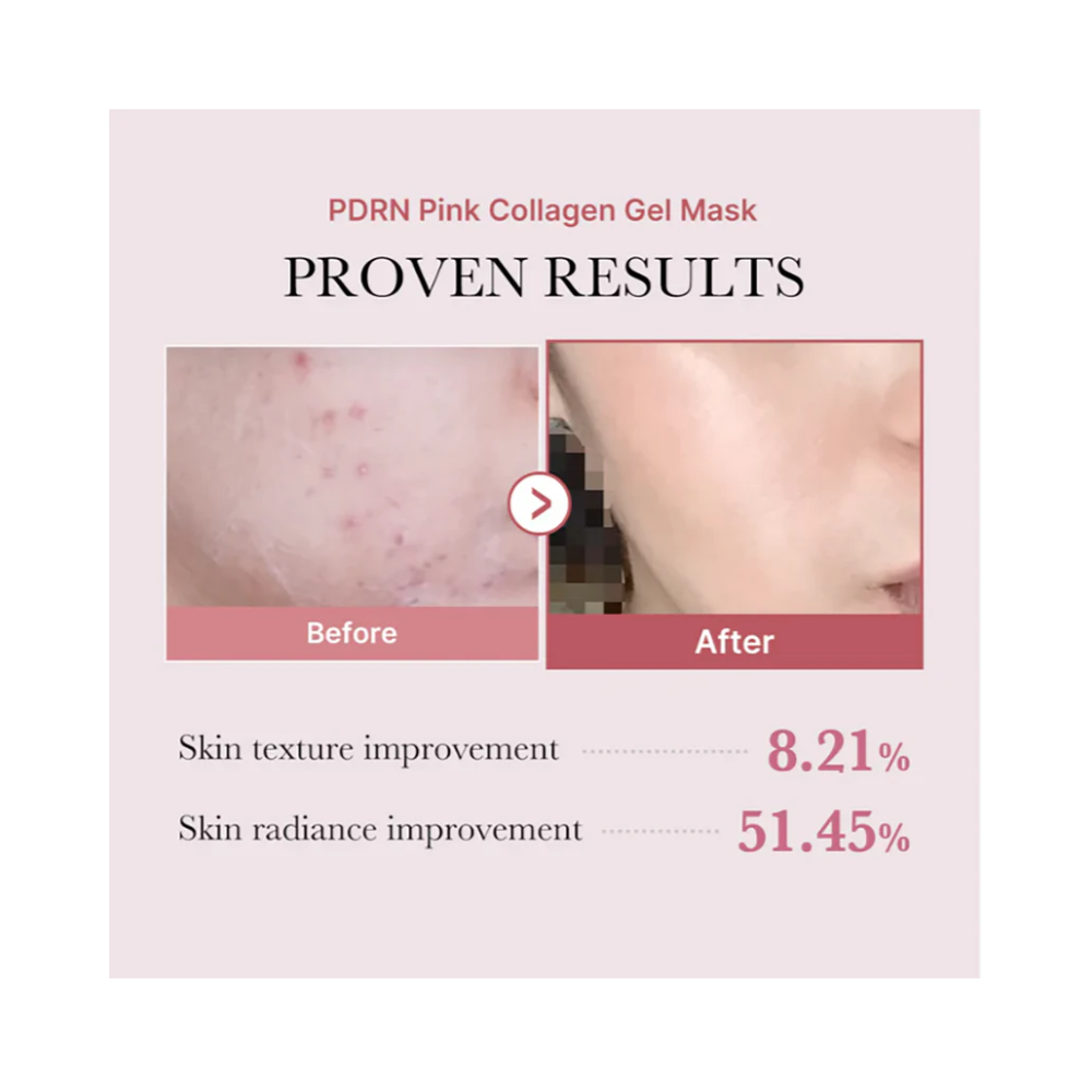 Medicube Salmon PDRN Pink Collagen Jelly Gel Mask, 28 g