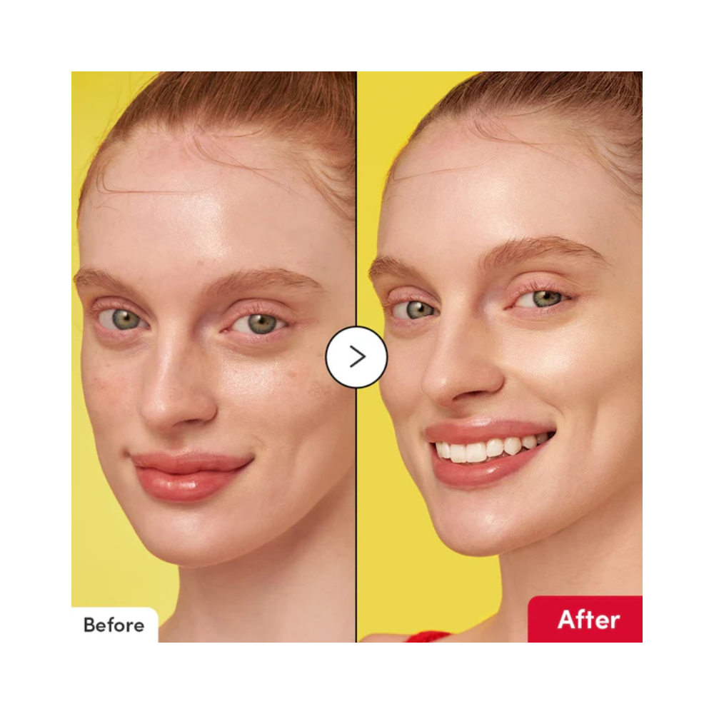 Eqqualberry Vitamin Illuminating Serum, 30 ml