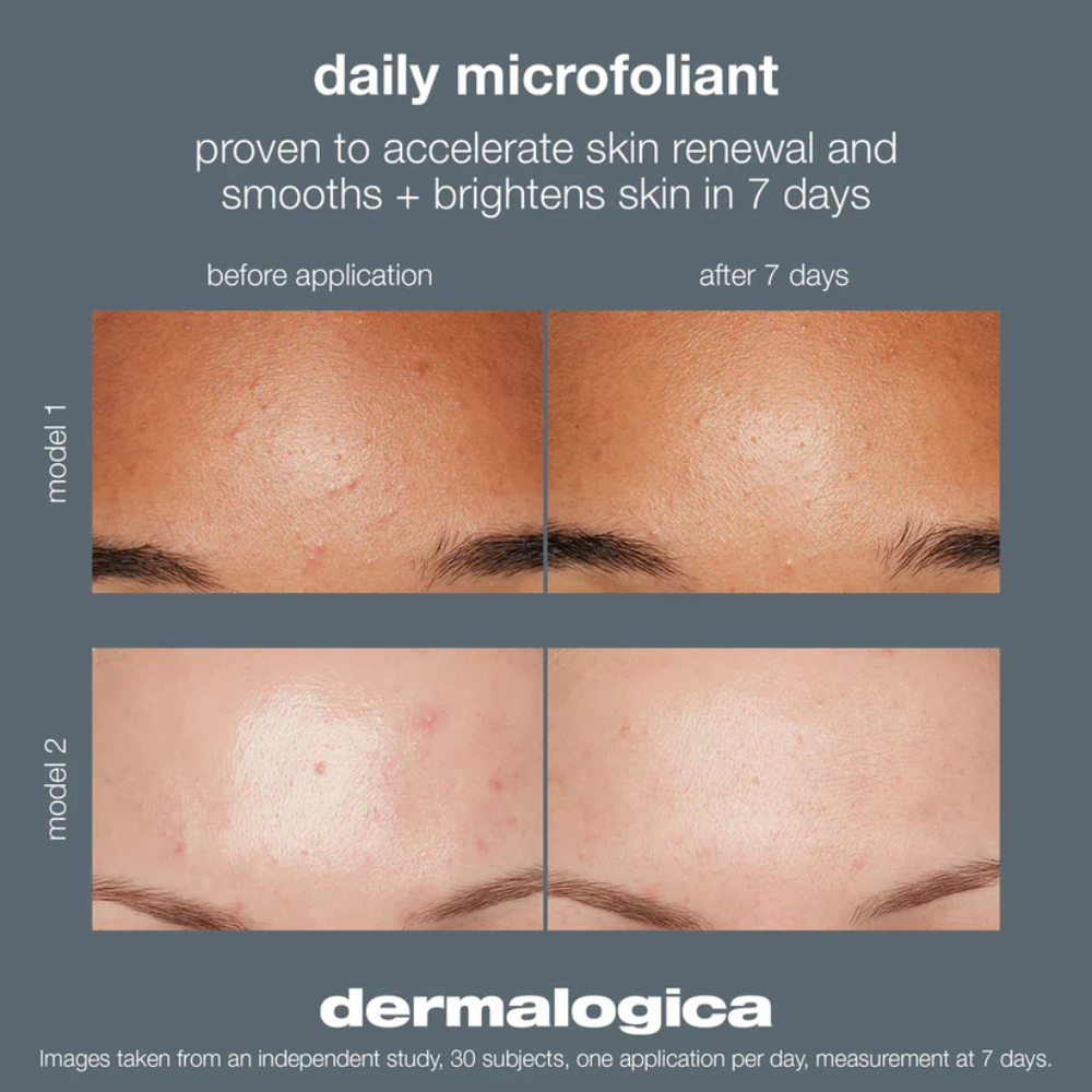 Dermalogica Daily Microfoliant Exfoliator 74g/2.6oz