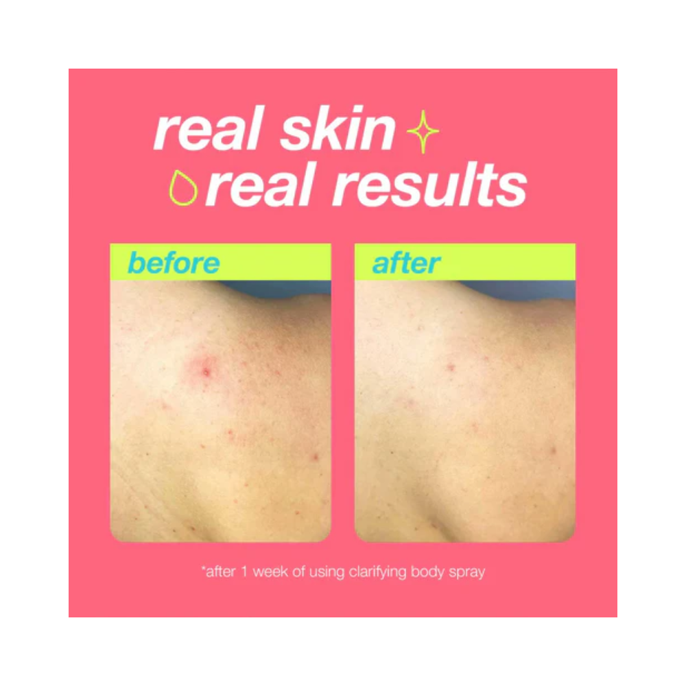 Dermalogica Clarifying Body Spray, 177ml